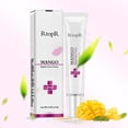 thumbnail image 4 of Limited time offer! Acne Extract Acne Removal Marks Facial, 4 of 9