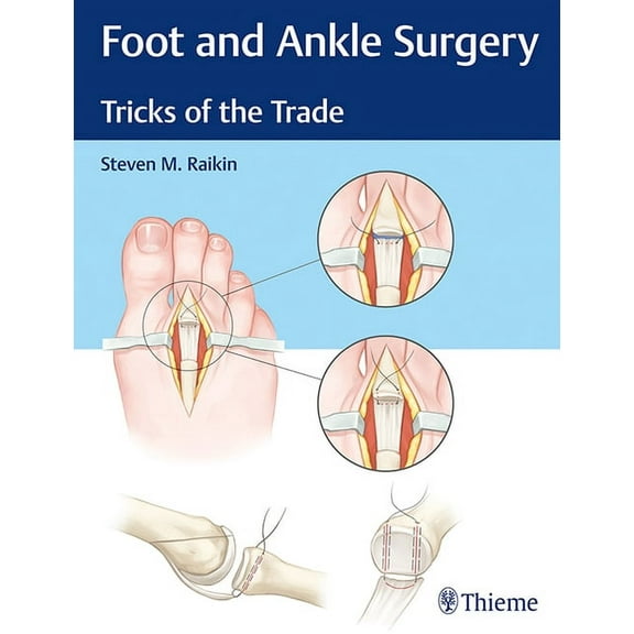 Foot and Ankle Surgery: Tricks of the Trade (Hardcover)