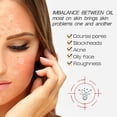 thumbnail image 3 of Suero facial de 30ml ácido salicílico hidratante esencia nutritiva para la piel productos de belleza JShteea Cuidado Belleza, 3 of 9