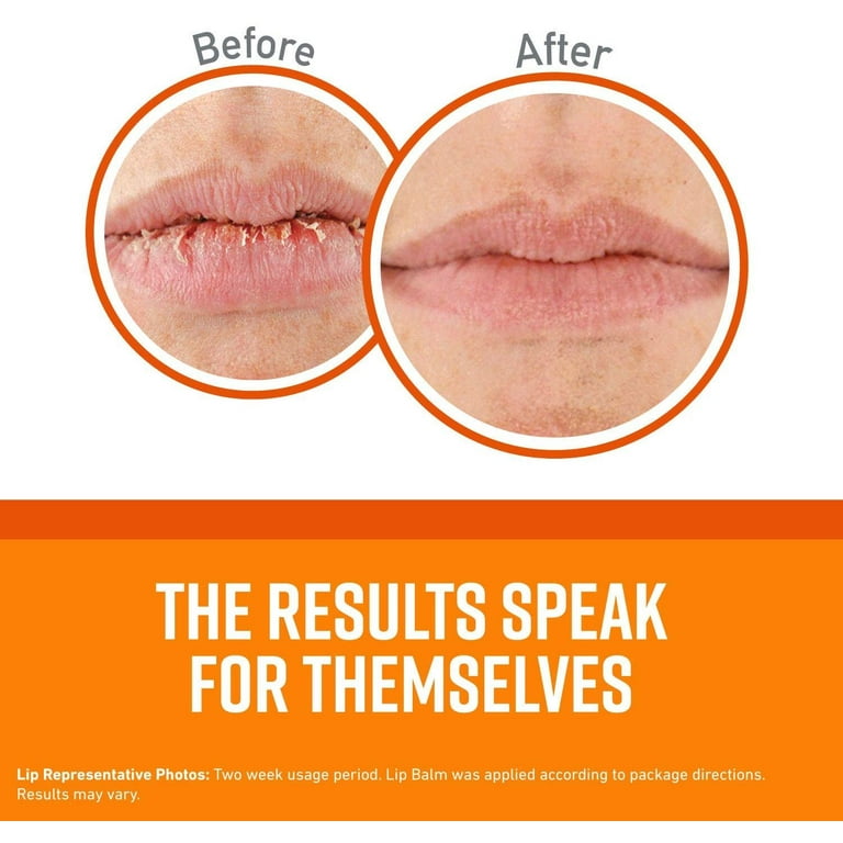 Why Are My Lips Sticking Out