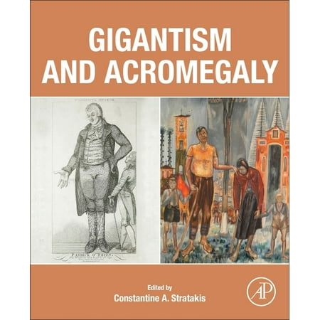UPC: 9780128145371 | Gigantism and Acromegaly (Paperback)
