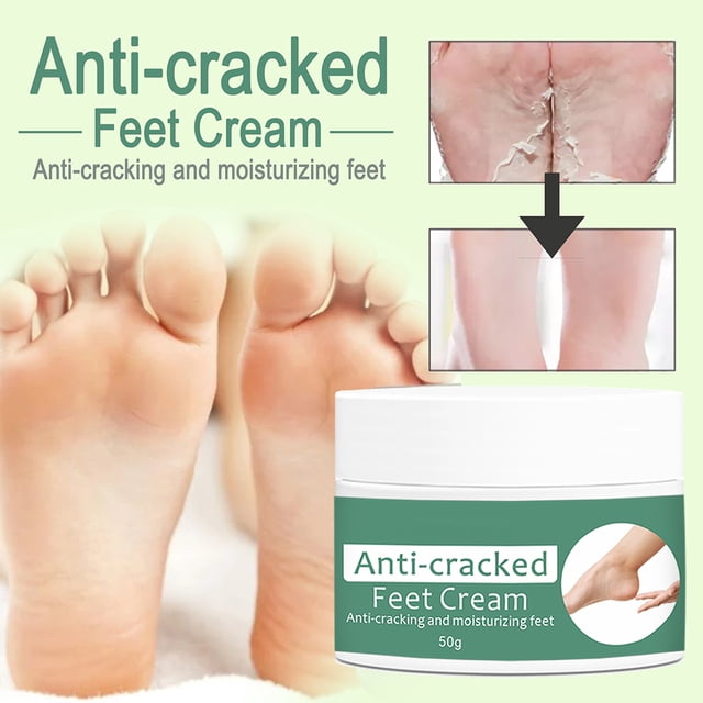 Crema Para Pies Hidratante Crema Para Pies Antigrietas Suaviza Los Callos Y La Piel Seca Y Áspera Cuidado De Los Pies Yuarrent CE007128-00