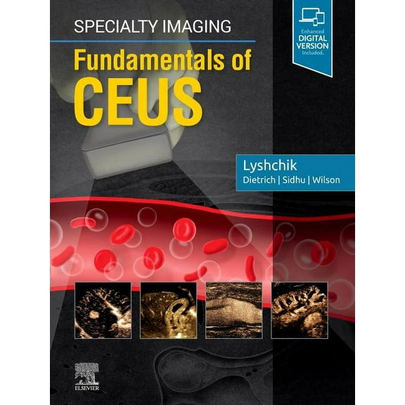 Specialty Imaging: Fundamentals of Ceus, (Hardcover)