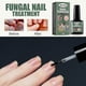 thumbnail image 3 of 26-27 Hand & Foot Grey Nail Treatment Thickening Soft Nail 15ml, 3 of 5