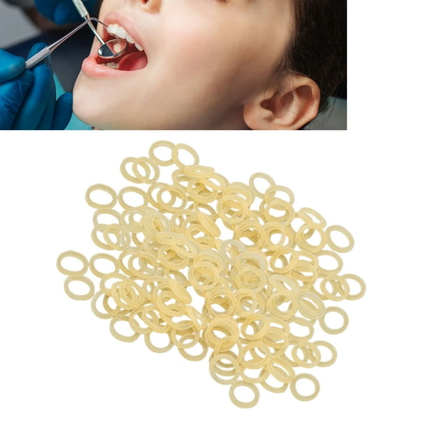 Elastics (Rubber Bands) in Orthodontic Treatment, Pediatric Dentistry &  Orthodontics of Central Iowa