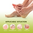 thumbnail image 4 of Bukihome Toe Separator for Overlapping Toes - 12 Pack Toe Spacers for Bunions with Lavender Extract - Toe Corrector for Hammer Toes, Realign Crooked Toes (Multi-Size, Lavender), 4 of 8