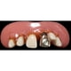 thumbnail image 3 of The Original Billy-Bob Big Cletus Novelty Teeth Billy Bob 10100, 3 of 5