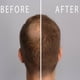 thumbnail image 5 of Shampoo anticaída para hombre AllSkin, 5 of 6