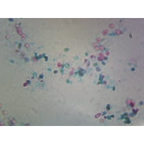 Saccharomyces Cerevisiae, Budding Cells; Whole-mount by Go Science Crazy