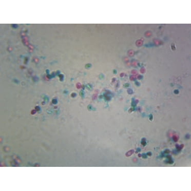 Saccharomyces Cerevisiae, Budding Cells; Whole-mount by Go Science Crazy