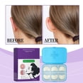 thumbnail image 3 of Corrector de oídos, 6 parches cosméticos de cinta adhesiva para orejas, adhesivos para sujetar las orejas, cinta adhesiva para orejas para adultos, corrección de Peltier., 3 of 8