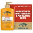 thumbnail image 3 of Gold Bond Medicated Intensive Relief Anti-Itch Lotion, 5.5oz, 3 of 10