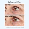 thumbnail image 3 of Bálsamo hidratante para ojos StriVectin Contour Restore Firming, 3 of 9