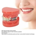 thumbnail image 4 of Model, Metal Wires Teeth Model 24 Teeth Orthodontics Resin  for Students for  Clinics, 4 of 7