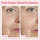 thumbnail image 5 of Suero Facial Retinol YEOUTH Acido Hialuronico Combo para el Cuidado de la Piel de Mujeres y Hombres, 5 of 7