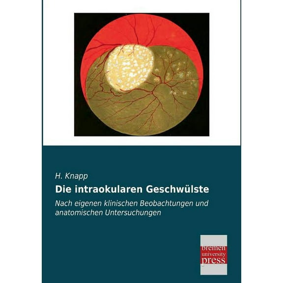 Die Intraokularen Geschwulste (Paperback)