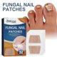 thumbnail image 3 of EELHOE toenail care patch, gray nail care patch, soft toenail, embedded nail, thickened bright nail groove care patch, 3 of 5