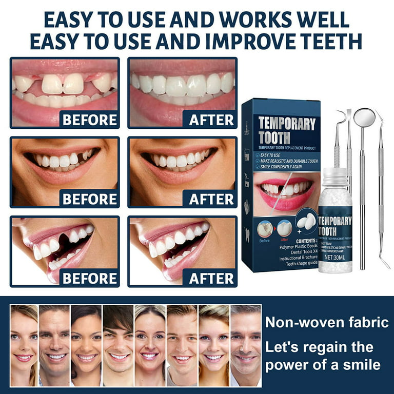 Plastic Teeth Glue Set Makeup Dentures Modified Temporary Filling Teeth Kit  
