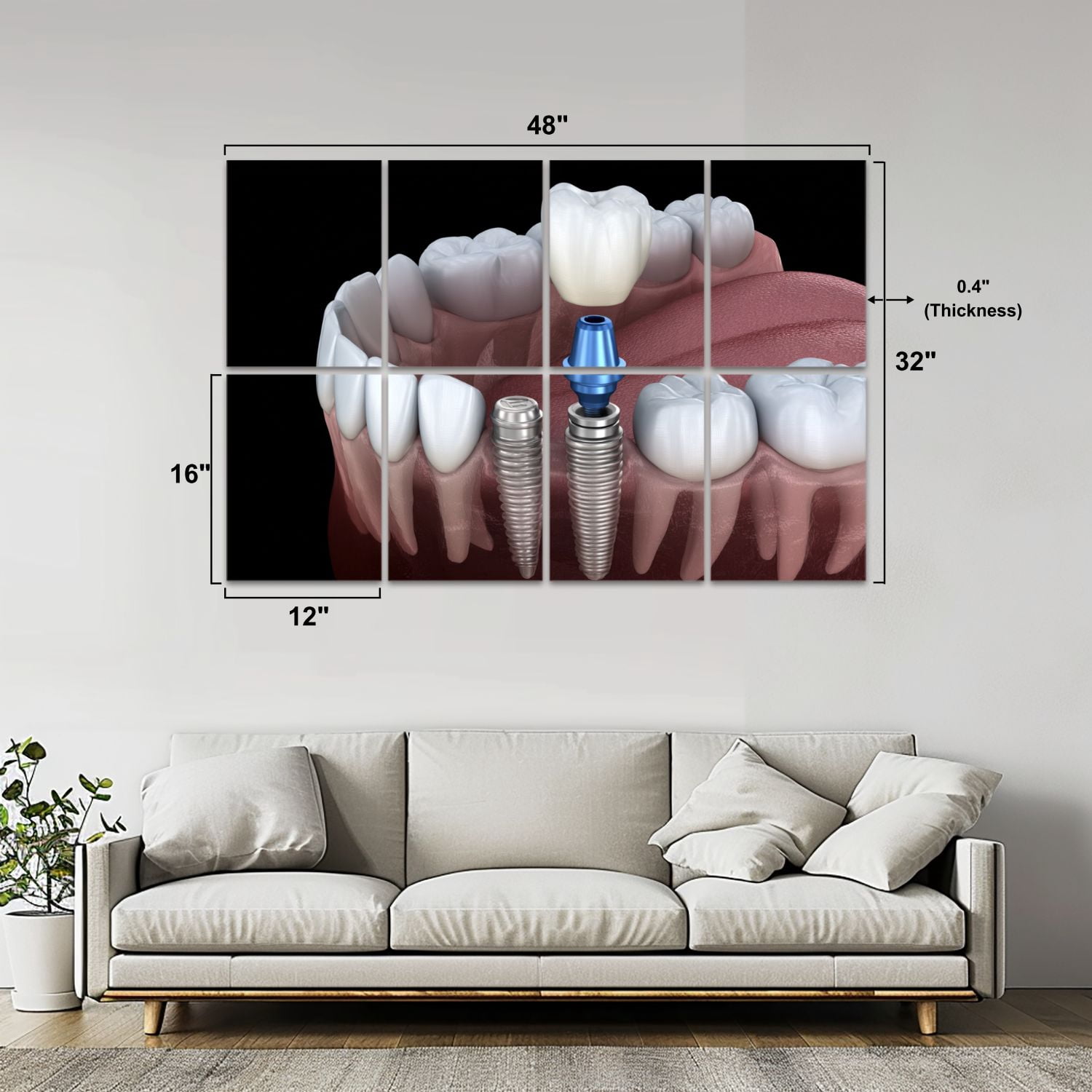 Dental 8 Pack Art Acoustic Panels Sound Absorbing Premolar tooth crown implant abutment Medically Decorative Soundproof Wall Panels Self Adhesive for Physician Hospital Office 48"x32"