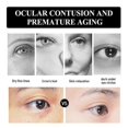 thumbnail image 3 of 1pc Snake Venom Peptide Moisturizing Eye Cream Moisturizing, Lightening Fine Lines, Anti-aging And Ant, 3 of 4