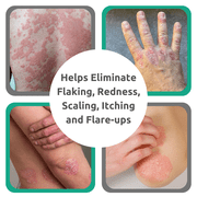 Dr. Blaines Revitaderm Psoriasis Formula, 4 oz