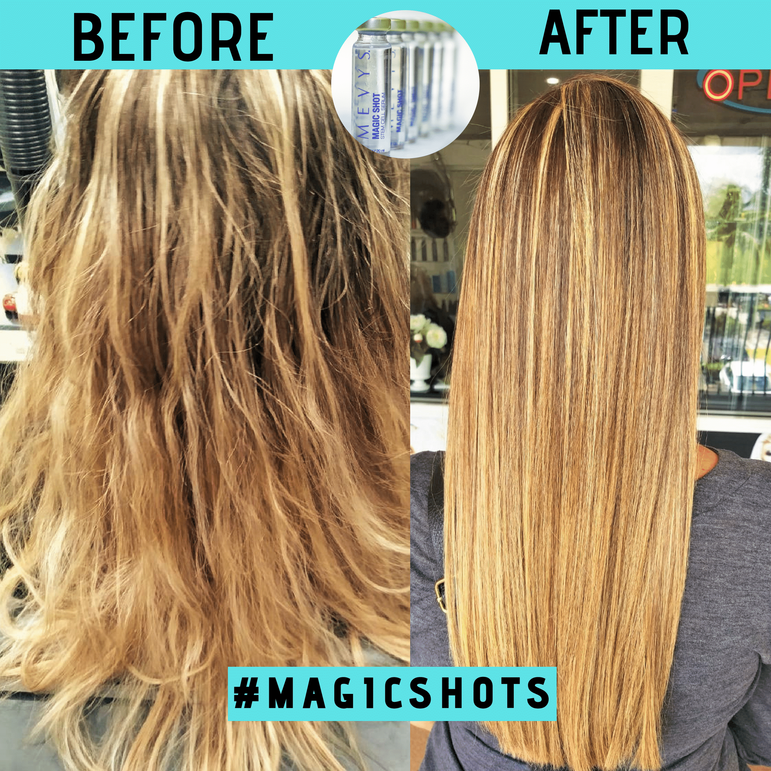 Mevys Magic Shot Apple Stem Cell Serum for All Hair Types 0.66 oz / 20 ml - Box of 6 Vials