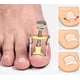 thumbnail image 2 of Kit de 2 Piezas CHAO Corrector Profesional de Uñas Encarnadas Tratamiento para Pies, 2 of 5