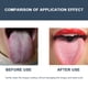 thumbnail image 2 of Cepillo limpiador de lengua de acero inoxidable Cuidado bucal Raspador de lengua de aliento fresco Ndcxsfigh  Cuidado Belleza, 2 of 6