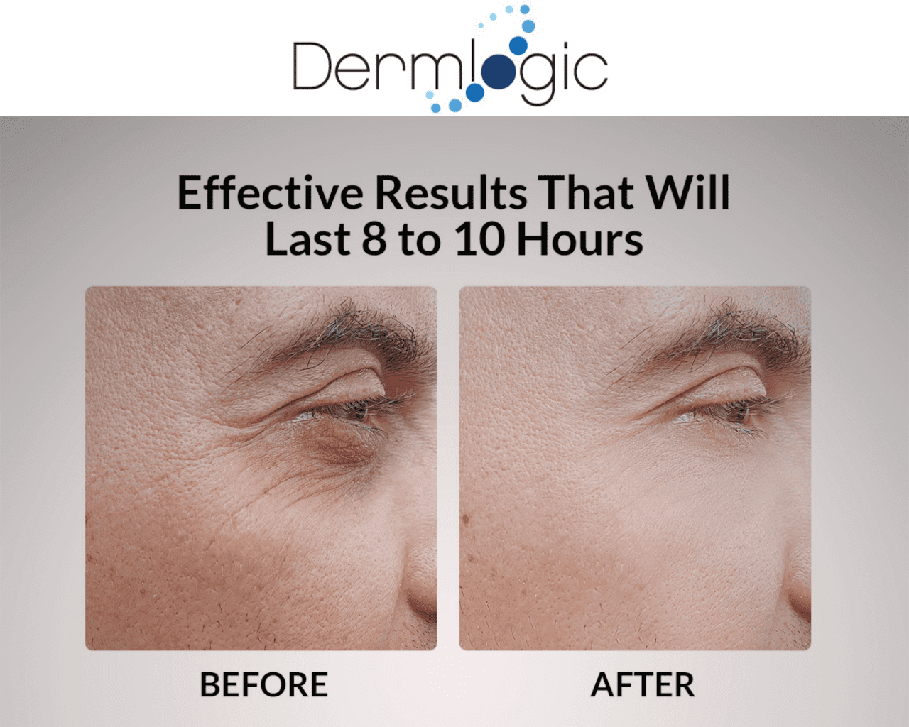 Dermlogic Instant Under Eye Puffiness, Dark Circles, Fine Lines Cream, 15 mL
