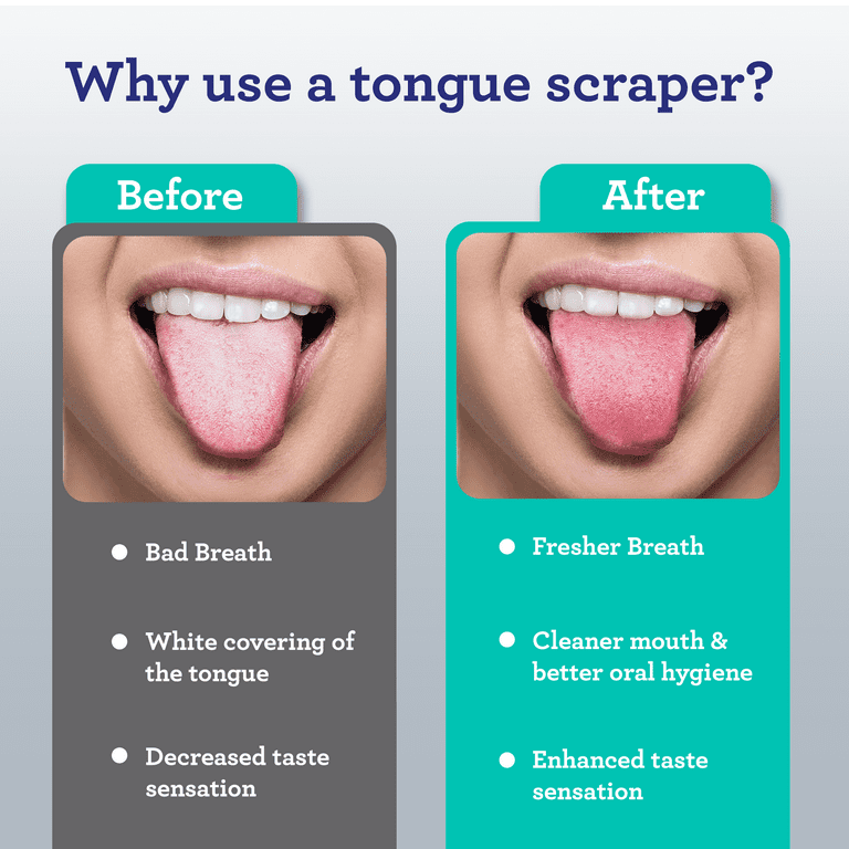 GuruNanda Stainless Steel Spoon Tongue Scraper, 2pk
