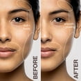 thumbnail image 4 of Dispositivo de depilación antienvejecimiento Dermaflash LUXE Plus, 4 of 5