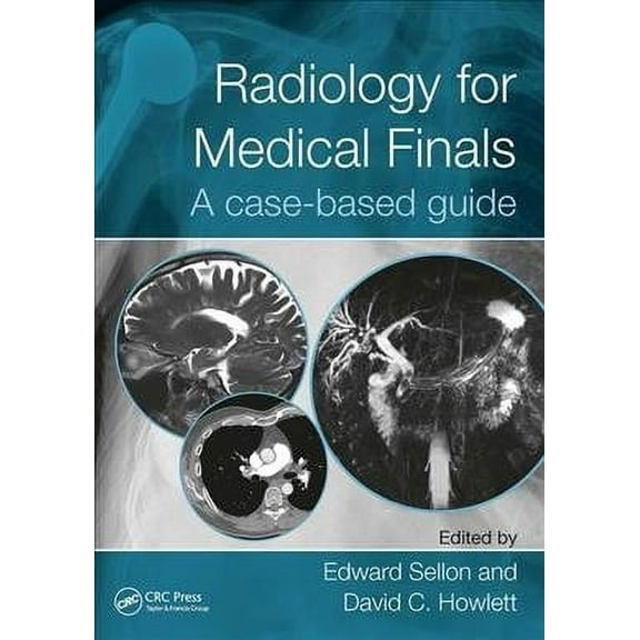 Radiology for Medical Finals: A Case-Based Guide (Paperback)