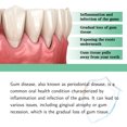 thumbnail image 1 of 3pcs Gum Care Drops Care For Gums Relieve Bubbling Oral Cleansing Drops, 1 of 5