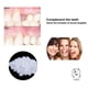 thumbnail image 3 of Pegamento Dental de 10/100g pegamento temporal sólido para dentadura pegamento para huecos de dientes pegamento para blanqueamiento Dental, 3 of 5