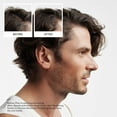 thumbnail image 4 of Nioxin Hair Care Kit System 2 (1 Month Supply), 4 of 6