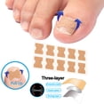 thumbnail image 4 of Parche Para Uñas De Los Pies, Corrección De Uñas De Los Pies, Telas No Tejidas, Parche Para Uñas De Pedicura, Diseño Compacto, Sin Pegamento Para El Cuidado De Los Pies En El, 4 of 7