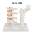 thumbnail image 2 of Eztrain Osteoporosis Model, Human Vertebrae Anatomical Model for Teaching Demonstration, 2 of 2