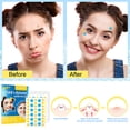 thumbnail image 1 of Fade Face Spot Repair Stickers Pimple Acné Corrector Maquillaje Corrector Impermeable, 1 of 9