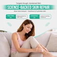 thumbnail image 7 of CLEAR 40 Urea Cream 40 Percent for Feet Maximum Strength (4oz) | Softens Cracked Heels & Dry Skin Urea Cream 40 Percent - Tea Tree & Coconut Oil | Urea Cream for Callus & Corn Treatment | Made in USA, 7 of 7