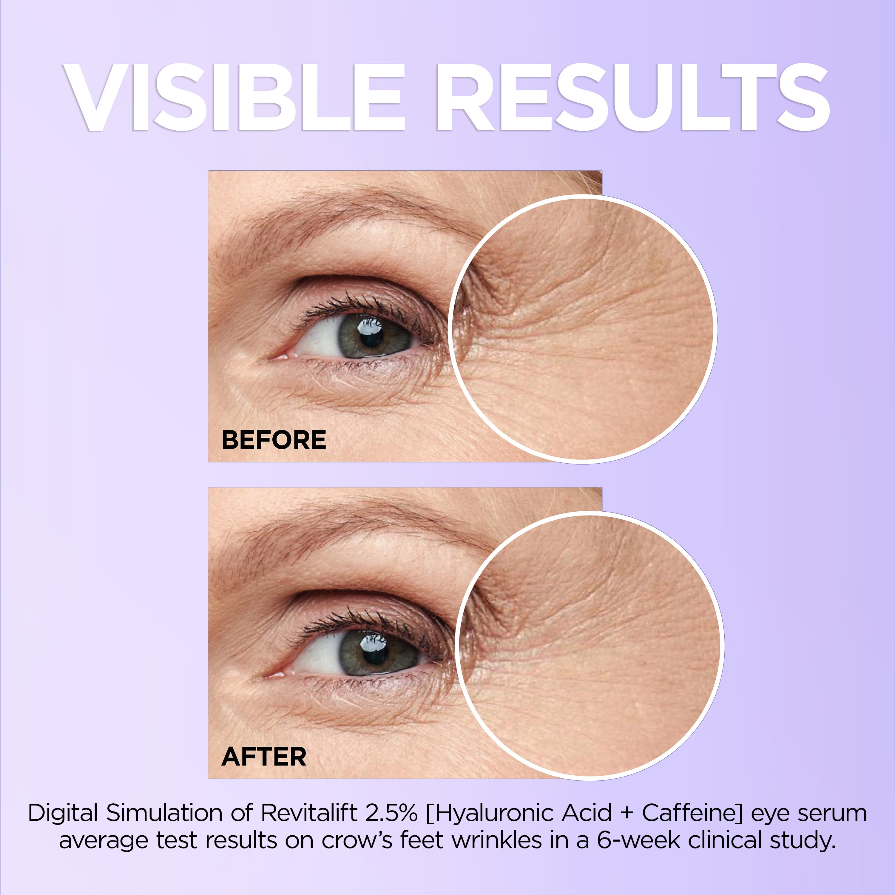 L'Oreal Paris Revitalift Caffeine Eye Serum, Replumps, 0.67 fl oz