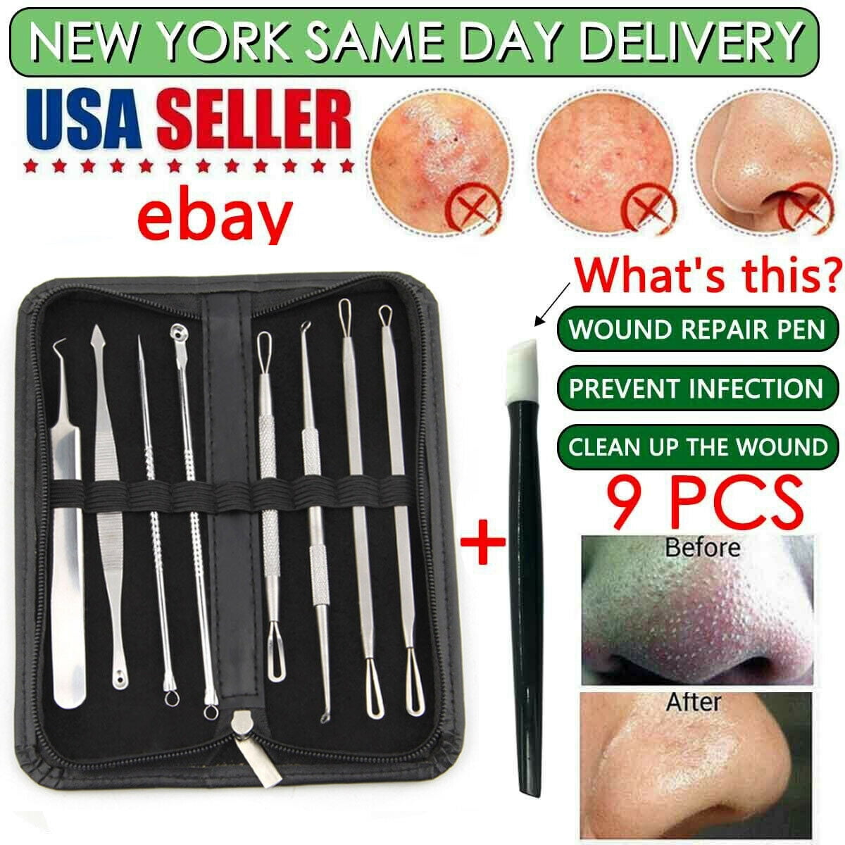 9 PCS Blackhead Acne Tweezers Pimple Blemish Extractor Remover Tool Kit Set USA