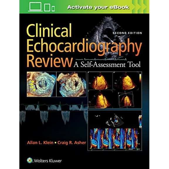 Pre-Owned Clinical Echocardiography Review (Paperback) 1451195370 9781451195378