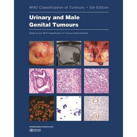 UPC: 9789283245124 | WHO Classification of Tumours: Urinary and Male Genital Tumours (Paperback)
