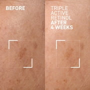 Dr. Brandt Triple Active Retinol