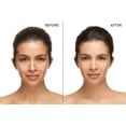 thumbnail image 2 of Viking Revolution Razor Bumps Treatment para mujeres - Suero para después del afeitado para mujeres - Tratamiento para el cabello encarnado con tapón de protuberancias para el área del bikini con ácid, 2 of 5