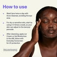 thumbnail image 4 of Limpiador facial Curology para el tratamiento del acné con peróxido de benzoilo al 2,5%, 4 of 8