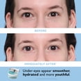 thumbnail image 4 of Kit de parches para ojos Peter Thomas Roth con vitamina C e hialurónico, 4 of 6