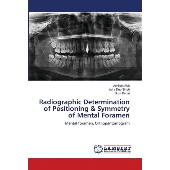 Radiographic Determination of Positioning & Symmetry of Mental Foramen (Paperback)