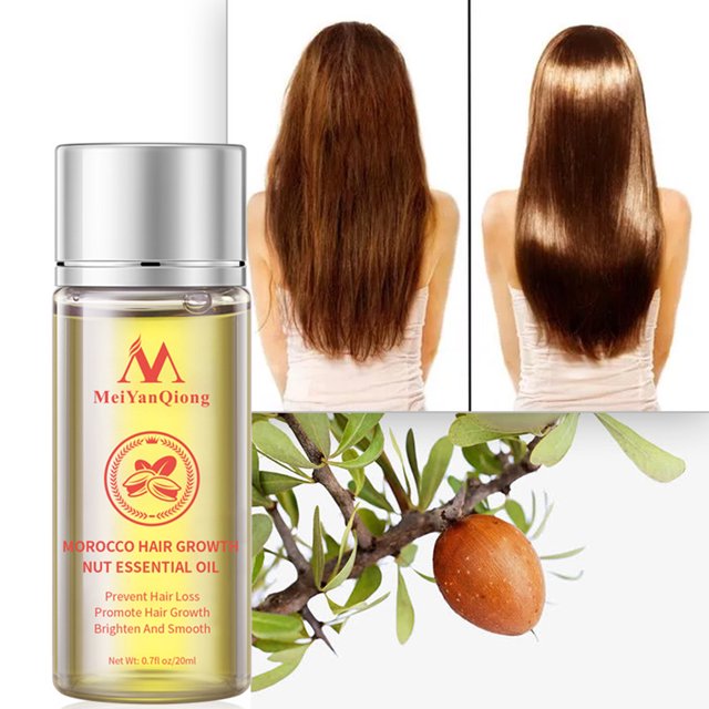 Aceite De Esencia De Nuez Aceite de esencia de nuez Cuidado del cabello Crecimiento del cabello Líquido Producto para la pérdida del cabello Ygjytge Cuidado Belleza