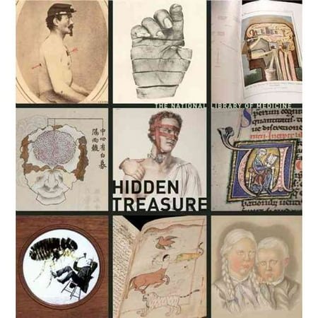 Hidden Treasure: The National Library of Medicine